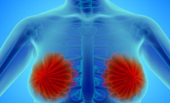 乳腺結節(jié)一定要切除嗎 需要及時手術治療的情況